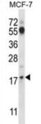 Zinc Ribbon Domain Containing 2 antibody, abx027521, Abbexa, Western Blot image 