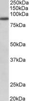 Fibroblast Growth Factor Receptor 1 antibody, LS-C154933, Lifespan Biosciences, Western Blot image 