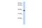 Protein Phosphatase 1 Regulatory Subunit 7 antibody, PA5-44565, Invitrogen Antibodies, Western Blot image 