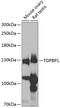 DNA Topoisomerase II Binding Protein 1 antibody, 14-513, ProSci, Western Blot image 