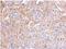 PPFIA Binding Protein 2 antibody, NBP1-33421, Novus Biologicals, Immunohistochemistry paraffin image 