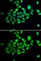 Dipeptidyl Peptidase 8 antibody, GTX65827, GeneTex, Immunocytochemistry image 