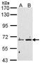 Peptidyl Arginine Deiminase 4 antibody, LS-C186338, Lifespan Biosciences, Western Blot image 