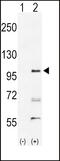 EPH Receptor A2 antibody, 63-038, ProSci, Western Blot image 