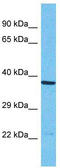 Olfactory Receptor Family 1 Subfamily N Member 1 antibody, TA337483, Origene, Western Blot image 