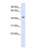 Interleukin 11 Receptor Subunit Alpha antibody, NBP1-62351, Novus Biologicals, Western Blot image 