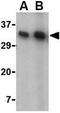 CD82 Molecule antibody, GTX31310, GeneTex, Western Blot image 