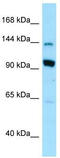 USO1 Vesicle Transport Factor antibody, TA338217, Origene, Western Blot image 