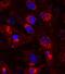 Natriuretic Peptide A antibody, AF3366, R&D Systems, Immunocytochemistry image 