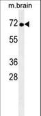 Non-receptor tyrosine-protein kinase TNK1 antibody, LS-C160084, Lifespan Biosciences, Western Blot image 