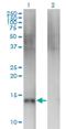 Semaphorin 4B antibody, H00010509-M03, Novus Biologicals, Western Blot image 