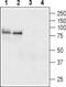 Thyroid Stimulating Hormone Receptor antibody, PA5-77758, Invitrogen Antibodies, Western Blot image 