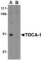 Formin Binding Protein 1 Like antibody, MBS150174, MyBioSource, Western Blot image 