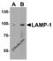 Lysosomal Associated Membrane Protein 1 antibody, 3629, ProSci, Western Blot image 
