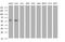 Adrenocortical dysplasia protein homolog antibody, MA5-25899, Invitrogen Antibodies, Western Blot image 