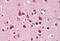 Nuclear Receptor Subfamily 3 Group C Member 1 antibody, MBS249109, MyBioSource, Immunohistochemistry paraffin image 