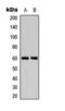 Calcium/Calmodulin Dependent Protein Kinase IV antibody, orb393230, Biorbyt, Western Blot image 