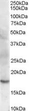 Cofilin 2 antibody, LS-B9191, Lifespan Biosciences, Western Blot image 