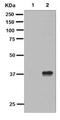 NFKB Inhibitor Alpha antibody, ab133462, Abcam, Western Blot image 