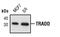 TNFRSF1A Associated Via Death Domain antibody, MA5-15063, Invitrogen Antibodies, Western Blot image 