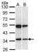 SH3 Domain Containing GRB2 Like 1, Endophilin A2 antibody, NBP1-33545, Novus Biologicals, Western Blot image 