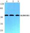 Aldehyde dehydrogenase X, mitochondrial antibody, A05637, Boster Biological Technology, Western Blot image 