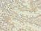 Nucleoporin 58 antibody, LS-C380083, Lifespan Biosciences, Immunohistochemistry frozen image 