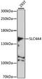 SLC4A4 antibody, STJ27285, St John