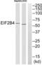 Eukaryotic Translation Initiation Factor 2B Subunit Delta antibody, abx014962, Abbexa, Western Blot image 