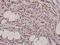 Cortactin antibody, A01253Y460, Boster Biological Technology, Immunohistochemistry frozen image 