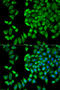 WNK1 antibody, STJ26212, St John