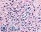 P2Y purinoceptor 12 antibody, LS-A3742, Lifespan Biosciences, Immunohistochemistry paraffin image 