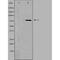 NADH:Ubiquinone Oxidoreductase Core Subunit S1 antibody, MBS001881, MyBioSource, Western Blot image 