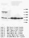 S100 Calcium Binding Protein B antibody, AP23250PU-N, Origene, Western Blot image 