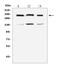 Collagen Type IV Alpha 1 Chain antibody, M01411, Boster Biological Technology, Western Blot image 