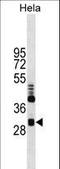 Chloride Intracellular Channel 4 antibody, LS-C96444, Lifespan Biosciences, Western Blot image 