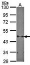 Signal Transducing Adaptor Family Member 2 antibody, orb69946, Biorbyt, Western Blot image 