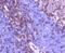 Integrin Subunit Alpha L antibody, NBP2-67551, Novus Biologicals, Immunohistochemistry paraffin image 
