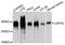 Ubiquitin Specific Peptidase 24 antibody, A10585, ABclonal Technology, Western Blot image 