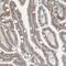 Transmembrane And Immunoglobulin Domain Containing 2 antibody, NBP1-81164, Novus Biologicals, Immunohistochemistry paraffin image 