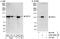 Signal-Induced Proliferation-Associated 1 antibody, A302-028A, Bethyl Labs, Immunoprecipitation image 
