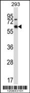 Myocyte Enhancer Factor 2D antibody, 57-537, ProSci, Western Blot image 