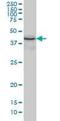 Endoplasmic Reticulum Protein 44 antibody, orb95136, Biorbyt, Western Blot image 