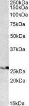 Proteasome Subunit Beta 4 antibody, orb20647, Biorbyt, Western Blot image 