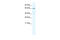 E3 ubiquitin-protein ligase TRIM41 antibody, 28-103, ProSci, Western Blot image 