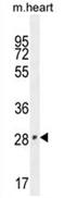 Vestigial Like Family Member 2 antibody, AP54511PU-N, Origene, Western Blot image 