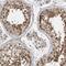 ZN341 antibody, HPA023240, Atlas Antibodies, Immunohistochemistry frozen image 