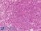 Platelet Derived Growth Factor Receptor Alpha antibody, LS-B9119, Lifespan Biosciences, Immunohistochemistry paraffin image 