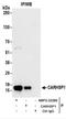 Calcium Regulated Heat Stable Protein 1 antibody, NBP2-22260, Novus Biologicals, Immunoprecipitation image 