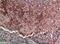 Tkt antibody, A01698, Boster Biological Technology, Immunohistochemistry paraffin image 
